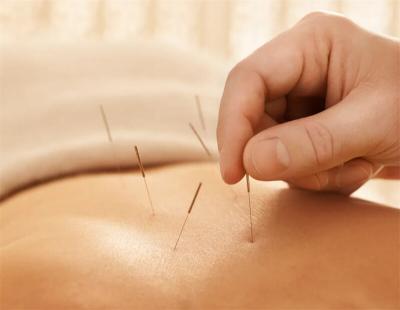 What is acupuncture 
