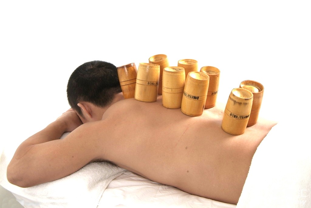 Cupping