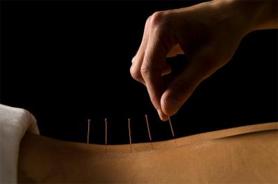 Acupuncture in China